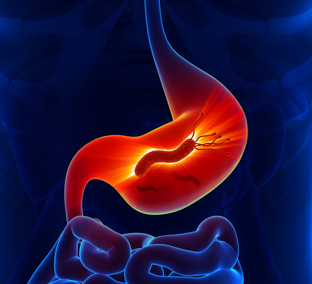helicobacter pylori